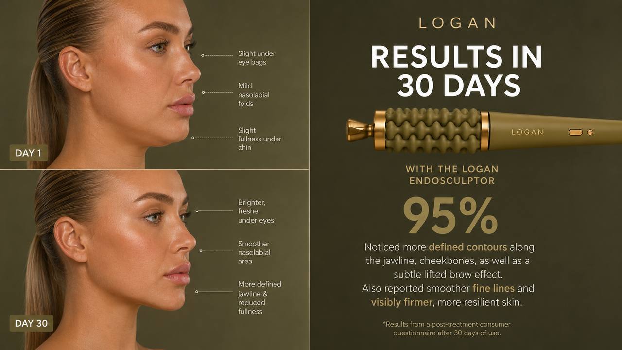 LOGAN Endosculptor before and after: jawline on Day 1 versus Day 30