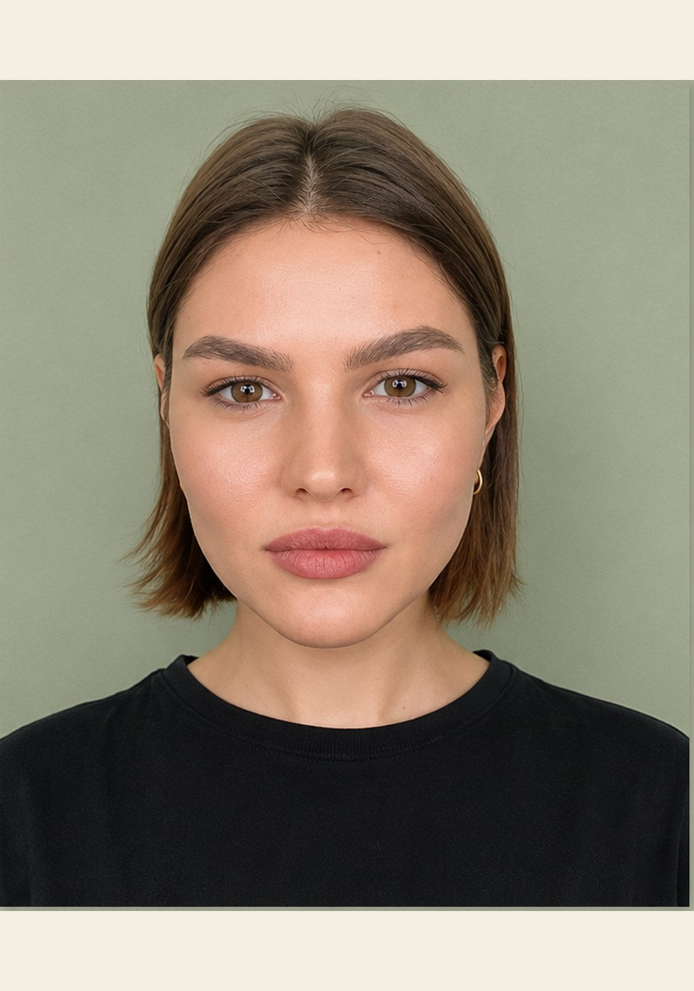 Front view, cheeks and jawline, after