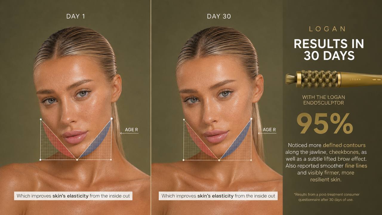 LOGAN Endosculptor results: Day 1 versus Day 30 face contours comparison
